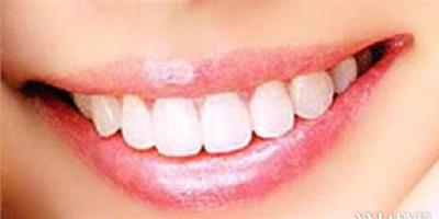 牙齒怎樣可以變白呢 為你介紹6個小妙招