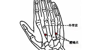 手背腰痛穴在哪裡 五個穴位治療腰痛