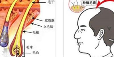 分析頭髮種植安全嗎 術前術後有哪些注意事項