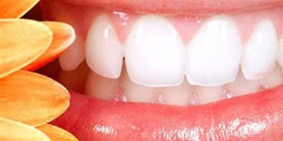 牙齒美白最快的方法是什麼 7種健康安全的方法值得一試