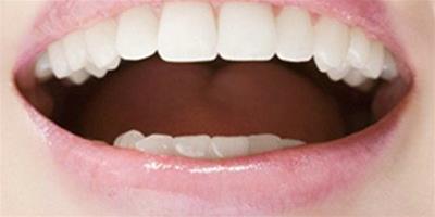 內源性牙黃怎麼變白呢 6個妙招讓你擁有潔白牙齒