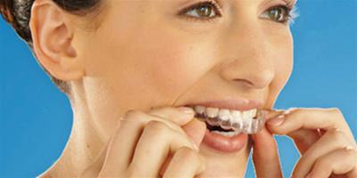 24歲矯正牙齒要多久 為你盤點矯正牙齒的利與弊