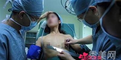 實拍女子矽膠隆胸過程 太恐怖了