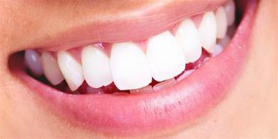 什麼方法有效美白牙齒 幾大訣竅讓你恢復自信笑容