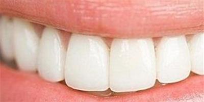 怎麼樣可以美白牙齒 教你4種快速美白牙齒方法