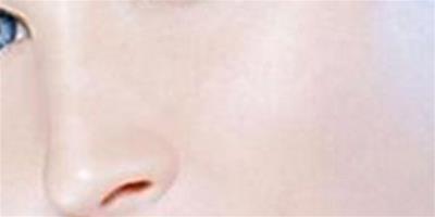 玻尿酸墊鼻子幾天能自然 最受歡迎隆鼻方式