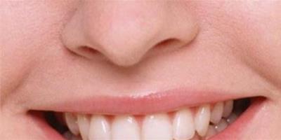 牙齒黃白怎麼辦呢 教你牙齒變白的七個小竅門