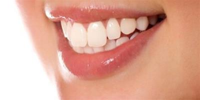 牙齒有裂紋是什麼原因 瞭解病因對症下藥才是關鍵