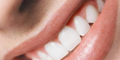如何清除牙石最有效？ 6大招還你亮白笑容