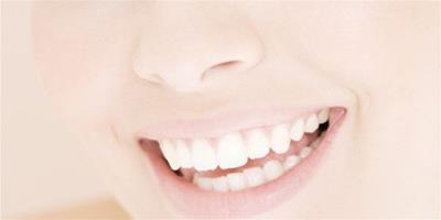 牙齒吸煙發黃怎麼快速變白 9大小竅門讓你牙齒美白如初