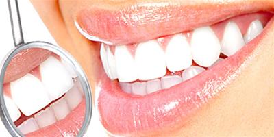 快速美白牙齒的偏方有哪些？ 7個小偏方有效助你美白牙齒