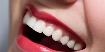 牙齒美白方法小偏方分享 七個方法讓你綻放自信露齒笑