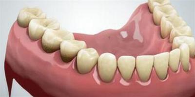 學會怎樣讓牙齒變白小妙招 7個小竅門讓你牙齒白回來