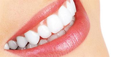 黃牙齒能洗白嗎 最有效的牙齒美白小竅門推薦