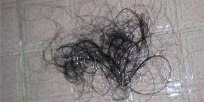 為什麼每次洗頭都掉好多頭髮 易掉頭發的五大原因