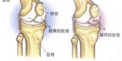 肌肉損傷怎麼治療 教你幾招如何輕鬆預防肌肉損傷