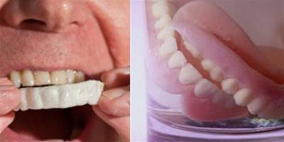 義齒是什麼 遠離牙病痛苦重現口腔健康