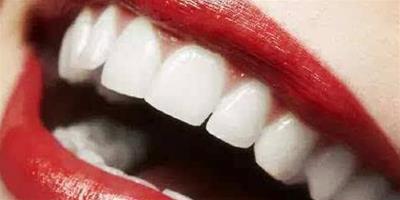 怎樣快速把黃牙刷白 7大快速美白牙齒方法告訴你