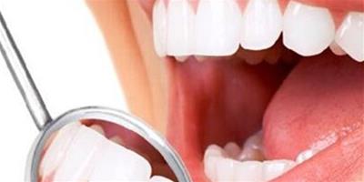 男人戒煙後洗牙能變白嗎 三招讓你擁有一口白牙