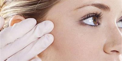 玻尿酸注射下巴多久可以洗臉嗎 微整形後的注意事項有哪些