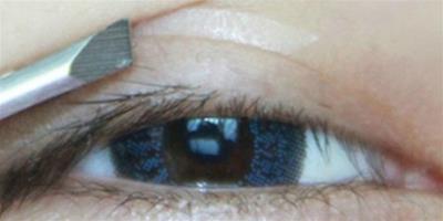 單眼皮變雙眼皮最快方法有哪些 三種方法教您擁有迷人大眼