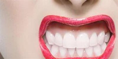 牙齒黃白點怎麼辦 幾個方法幫你快速美白牙齒