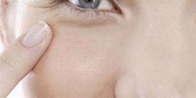 眼角幹紋怎麼去除 幹紋和細紋的區別在哪