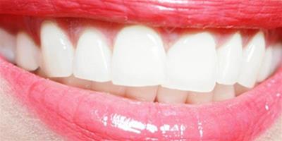 怎麼把牙齒上的汙質去掉 教你12種清除的方法