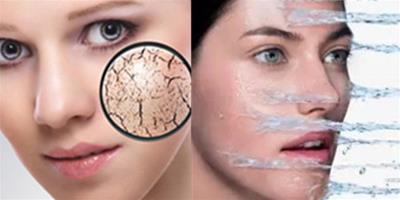 幹性皮膚用什麼護膚品好 這幾樣產品千萬不可缺