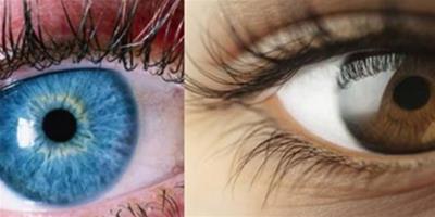 眼瞼水腫是怎麼回事 2個妙招幫你告別泡泡眼
