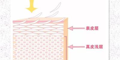 果酸換膚會不會復發 有良好的保養習慣才不會復發