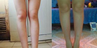 腿型分類彰顯不同風格 長期堅持鍛煉可以練就美腿
