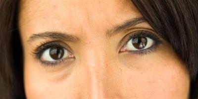 黑眼圈很重是腎虛嗎 讓你更瞭解自己