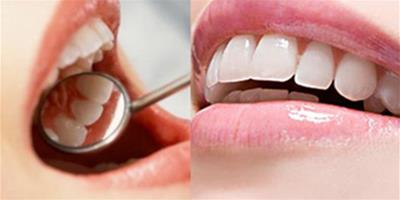牙釉質會再生嗎 只要這樣做它就一定能得到修復