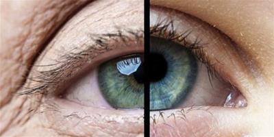 瞳孔變形 其中的具體原因你知道嗎