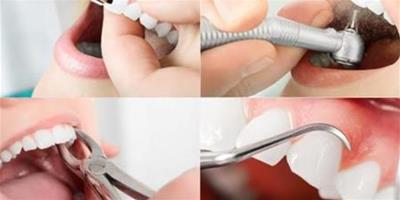 洗牙後注意事項有哪些 如何預防口腔問題發生