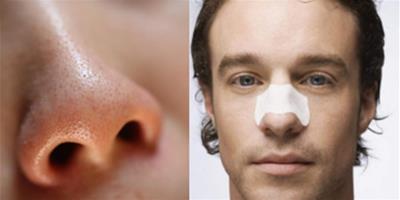 鼻頭毛孔粗怎麼辦 四大妙招讓你輕鬆解決肌膚問題