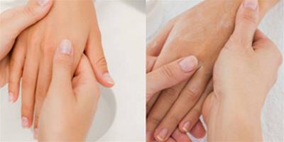 手脫皮乾燥怎麼辦 三個方法恢復完美肌膚