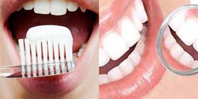 如何進行暴牙修復 技術發達非常容易