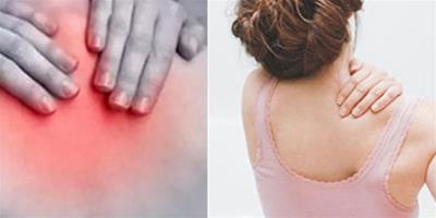 背部酸痛是什麼原因 不可忽視這三方面