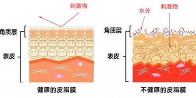 激素臉怎麼治療 這些治療誤區千萬注意