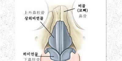 矽膠隆鼻取出多久消腫 隆鼻失敗修復術後消腫至少需14天