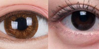 眼袋類型 讓你輕鬆辨別它們的不同