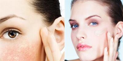 幹性皮膚洗面乳怎麼選 教你如何保護臉