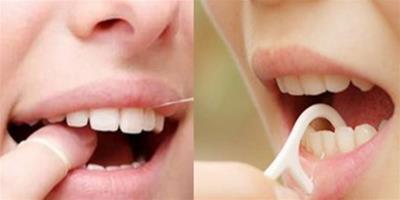 牙線的作用 想要健康牙齒離不開它