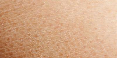 去雞皮膚最有效的方法 雞皮膚如何護理成滑嫩肌膚