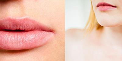 為什麼唇部有白色顆粒 這些皮膚問題如何解決