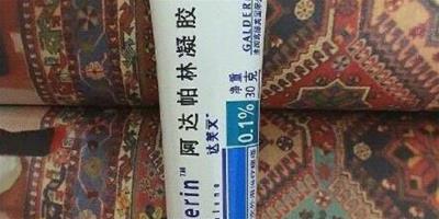 祛痘效果最好的產品 痘皮妹紙不容錯過