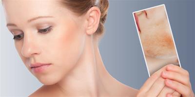 三種護膚方法讓你一步步成為敏感肌