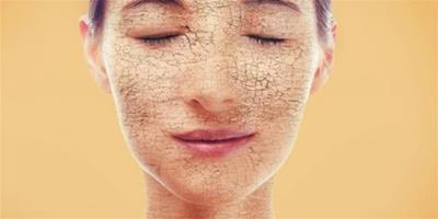 如果臉上起皮怎麼辦才好 什麼辦法能夠幫助肌膚補水